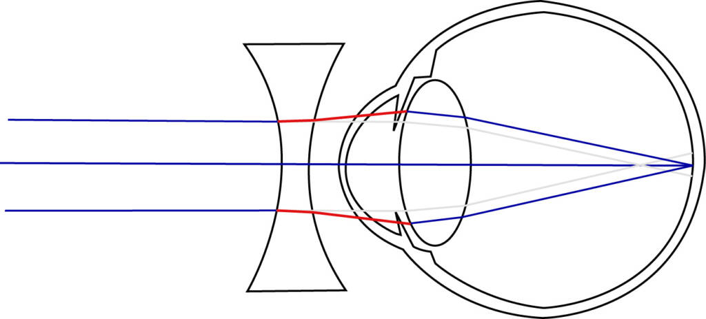 Likinäköisyys korjattuna linssillä